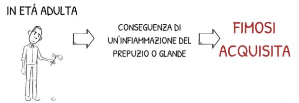 Fimosi Acquisita Fimosi Acquisita