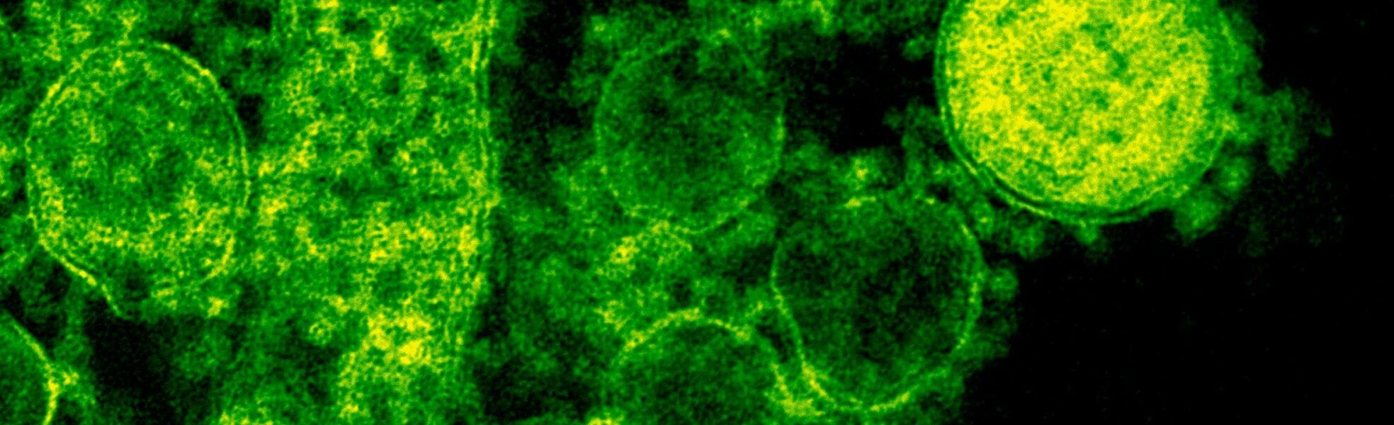 pexels-cdc-3992943 pexels-cdc-3992943